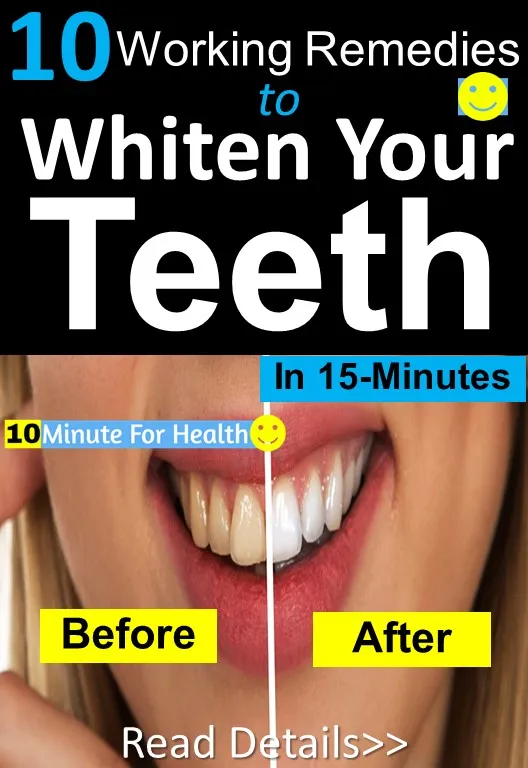 26026 teeth whitening foods