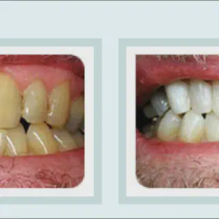 /img/26027-teeth-whitening-future.webp