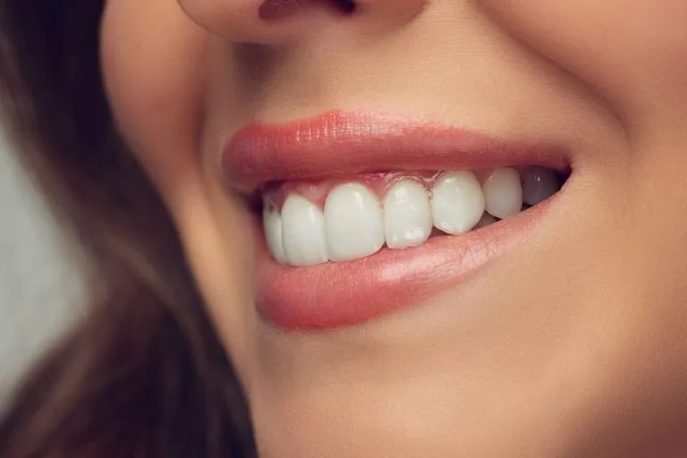 26029 teeth whitening hurts gums image4