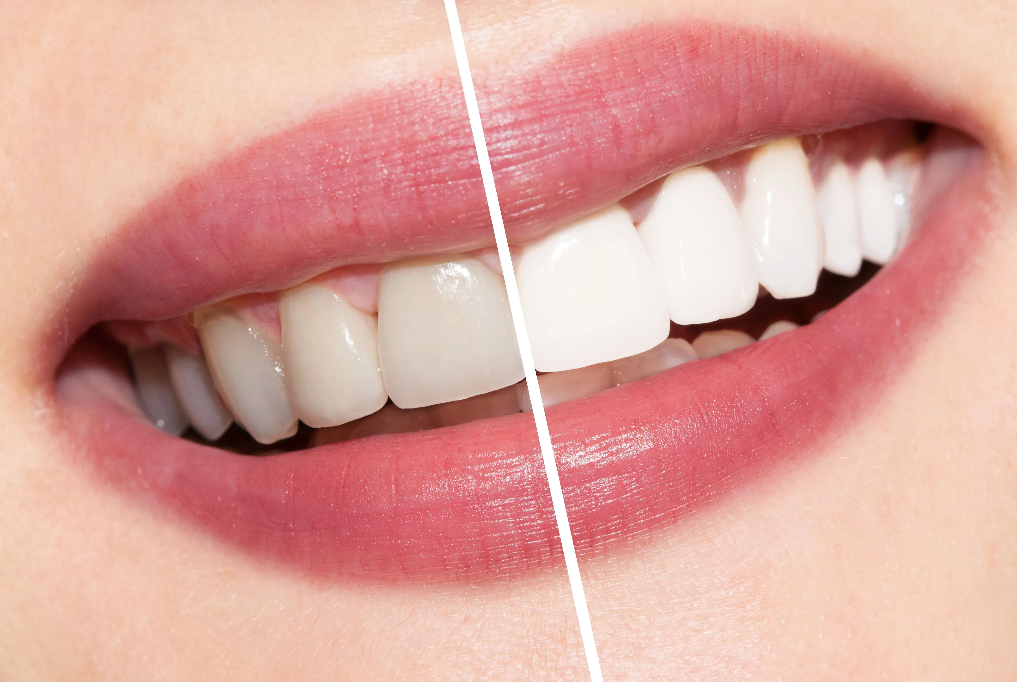 /img/26030-healthy-smile.webp