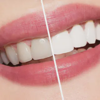 /img/26030-healthy-smile.webp