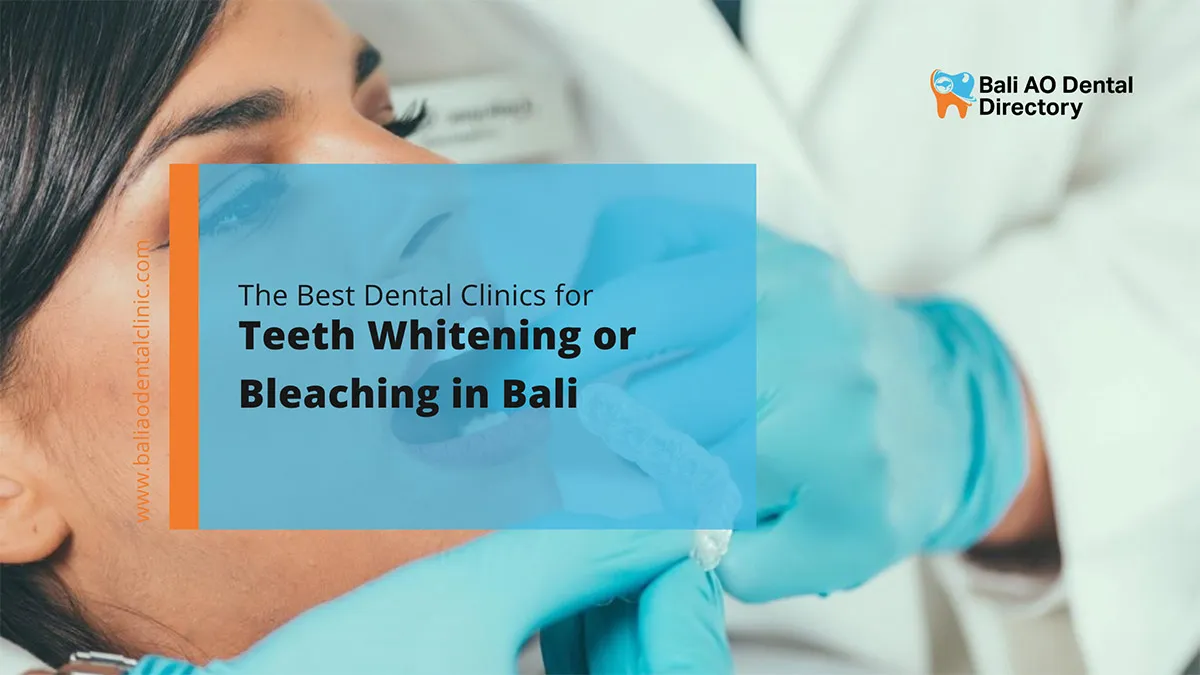 26030 teeth whitening customized treatment