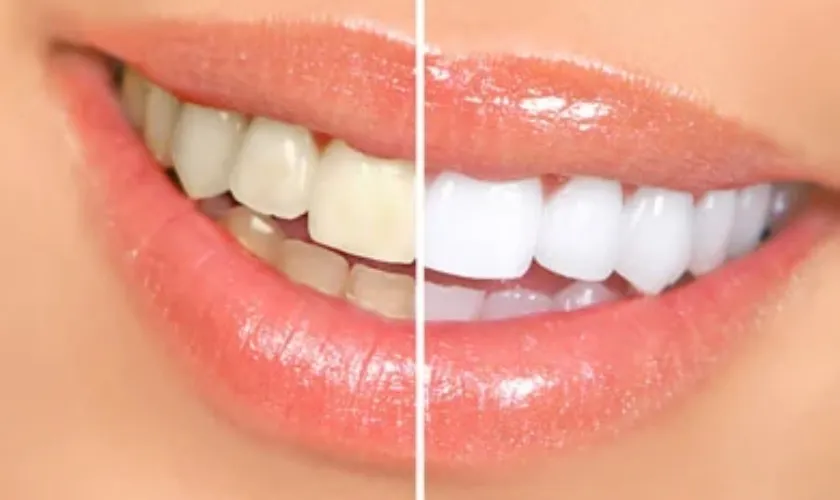 26031 sensitive teeth