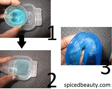 26035 professional teeth whitening