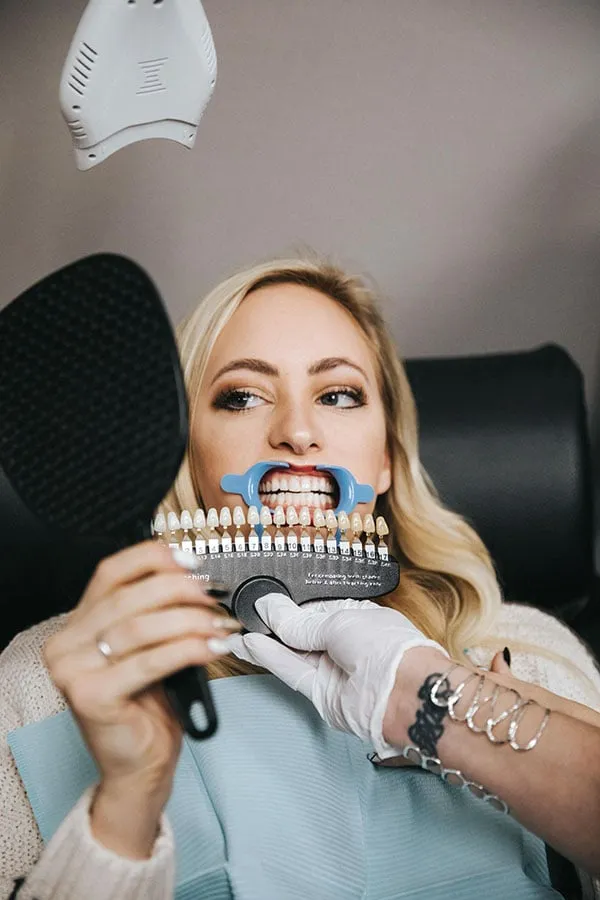 26043 teeth whitening treatment
