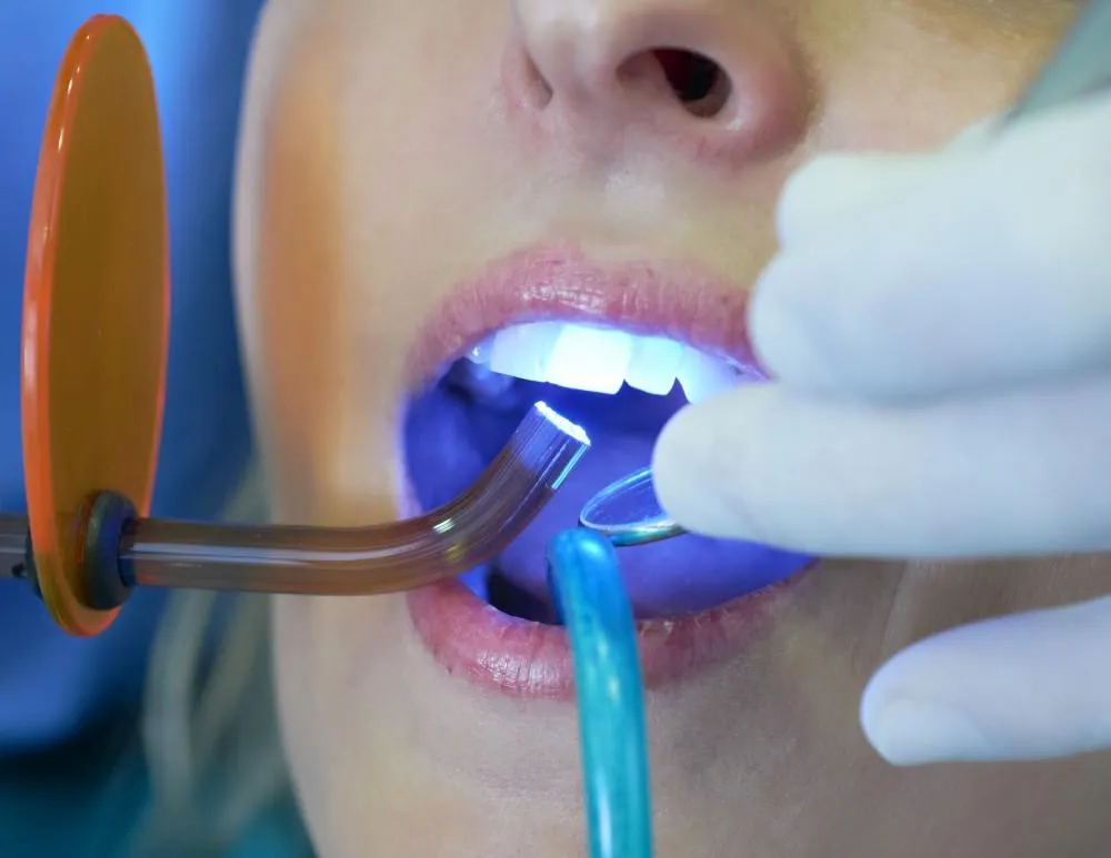 26044 white teeth diet oral hygiene image6