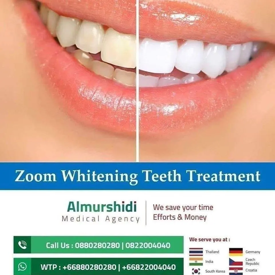 26046 teeth whitening south korea before after