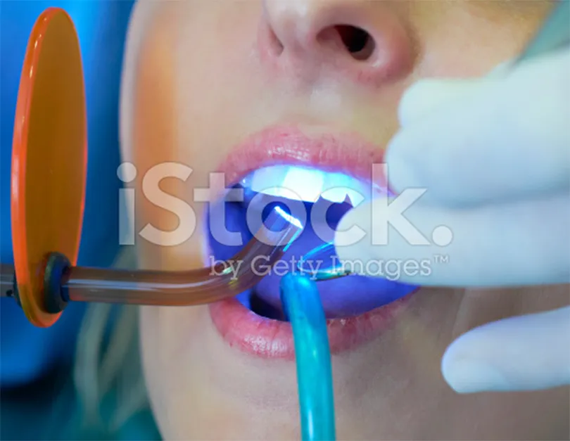 26047 take home teeth whitening