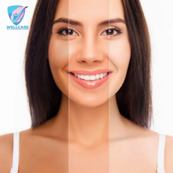 26048 mesotherapy ingredients