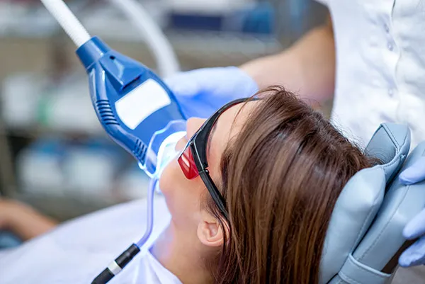26053 laser teeth whitening dangers dentist consultation