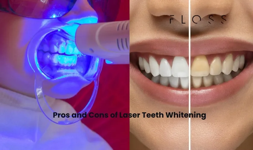 26053 laser teeth whitening dangers inconsistent results