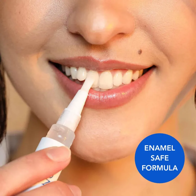 26060 xpassion teeth whitening application