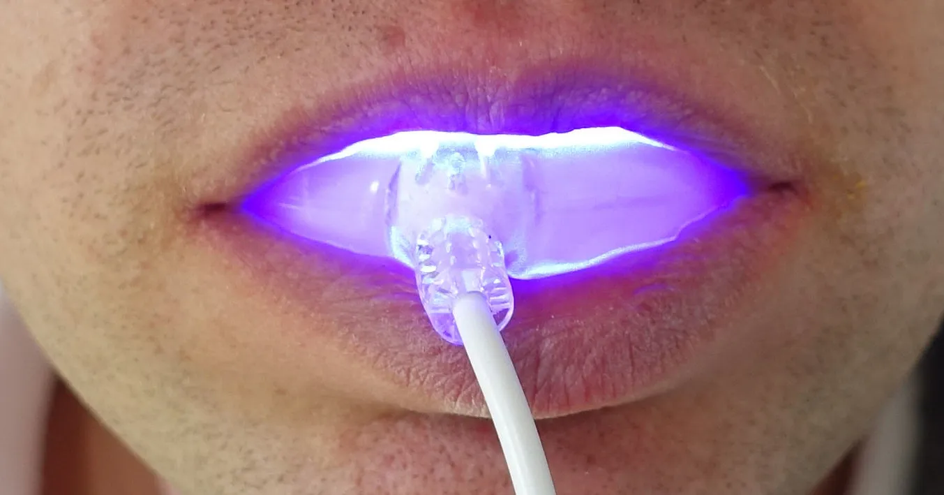 26061 teeth enamel uv light image4