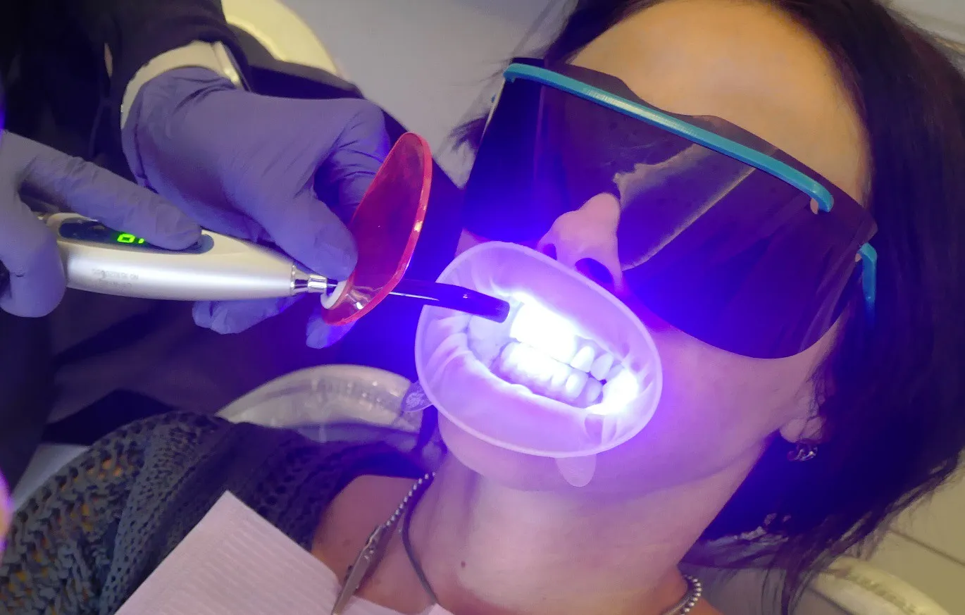 26061 uv light whitening teeth image3