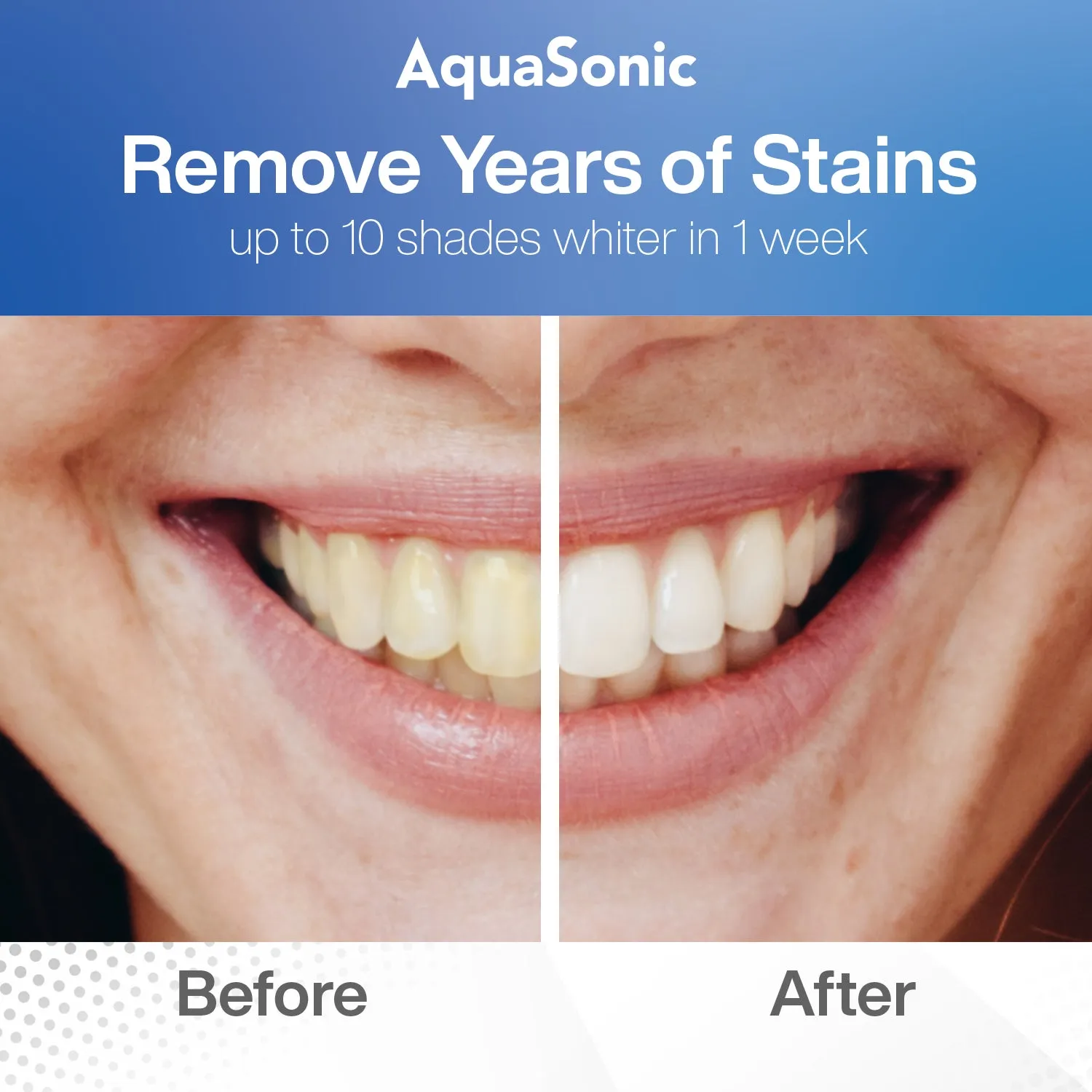26062 all plus whitening application