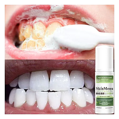 26063 tea stains teeth