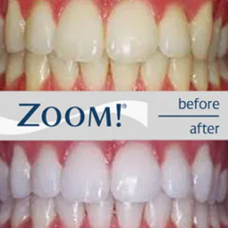 /img/26067-dental-checkups.webp