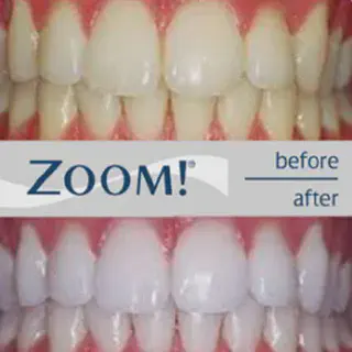 /img/26067-dental-checkups.webp
