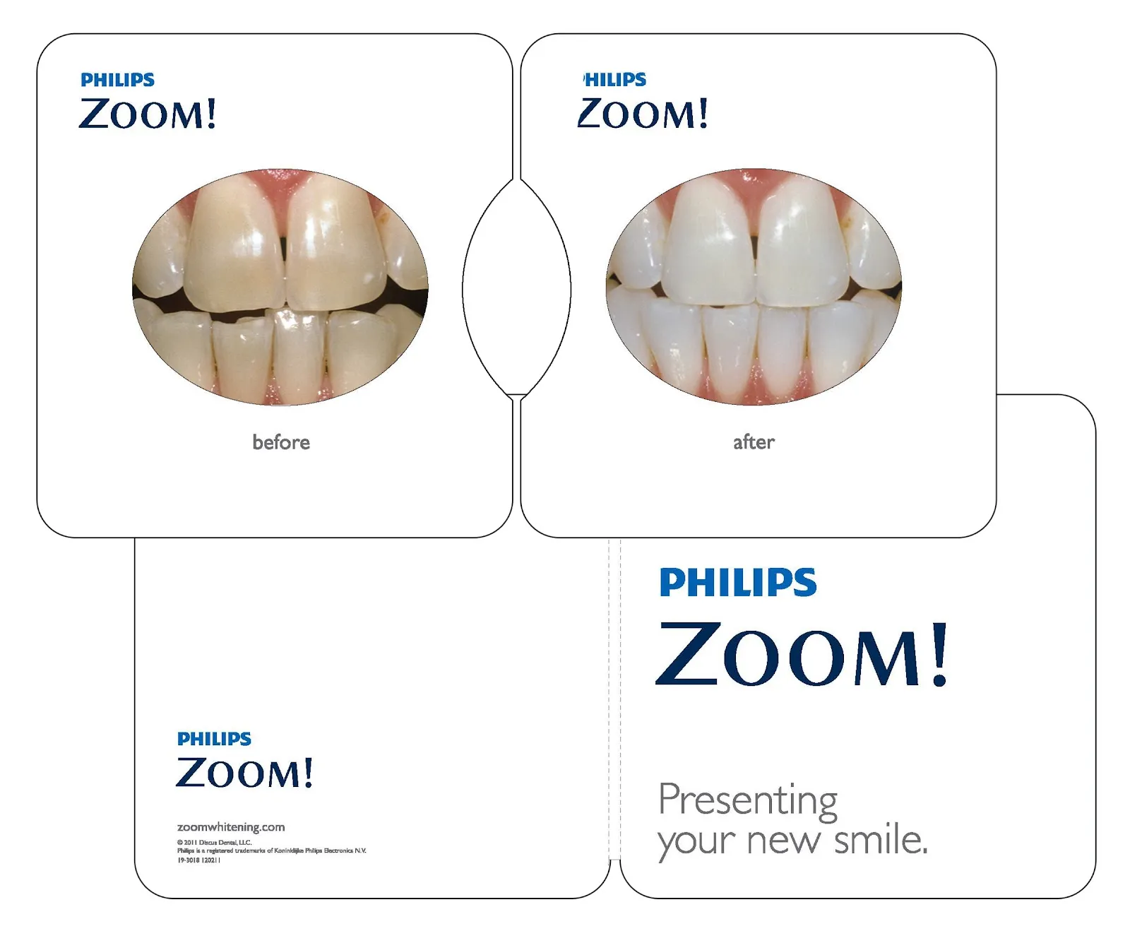 26067 teeth sensitivity