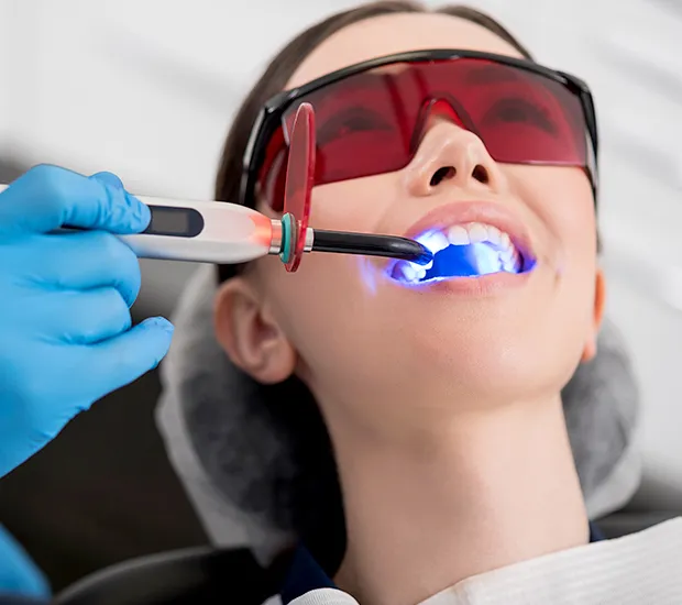 26072 at home whitening