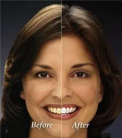26077 proper brushing techniques