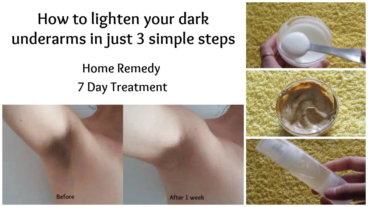 26087 baking soda