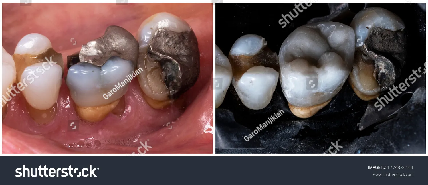 /img/26089-nano-teeth-whitening-consultation.webp