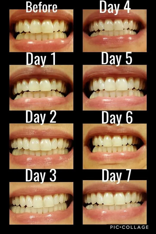 /img/26091-brushing-and-flossing.webp
