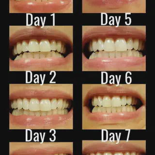 /img/26091-brushing-and-flossing.webp