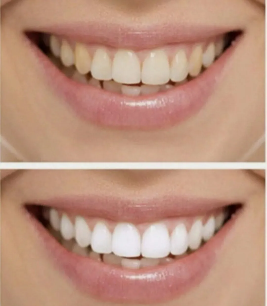 26094 bright smile confidence