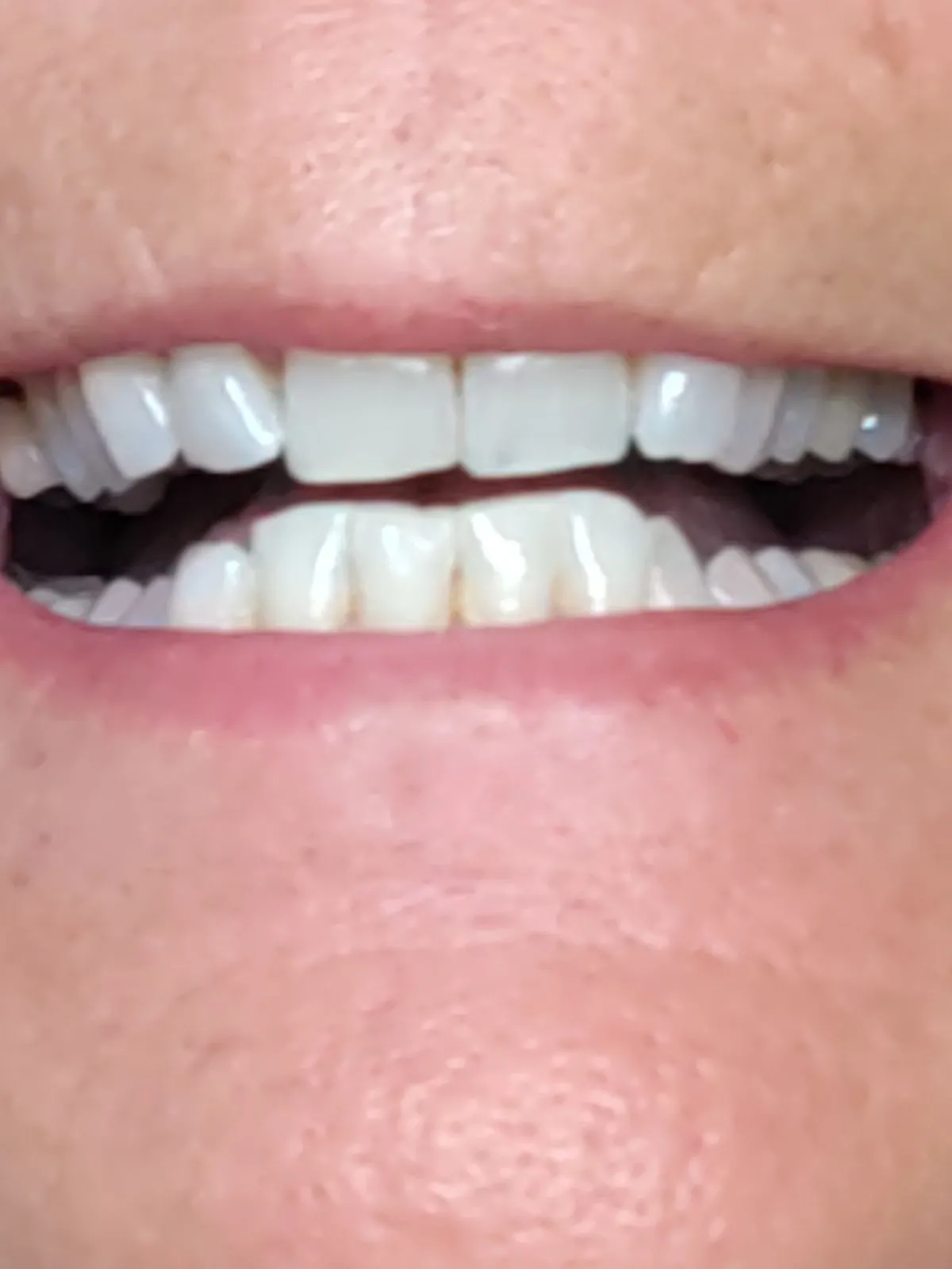 26094 cavity protection