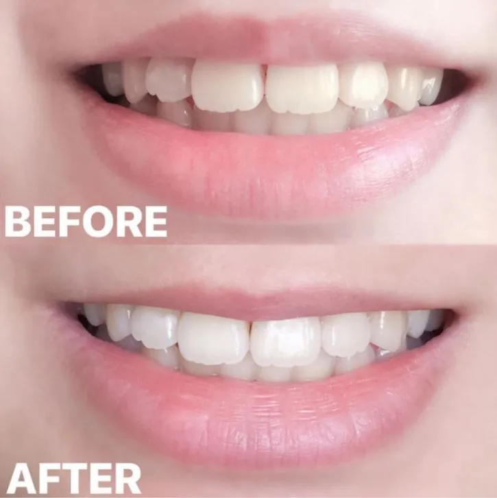 26096 smile lab confidence