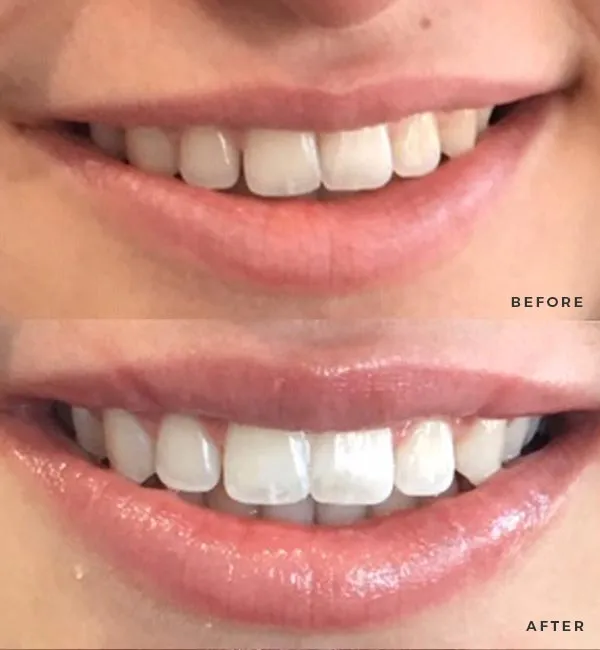 26096 smile lab oral health