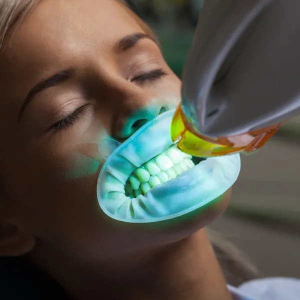 26100 teeth whitening procedure