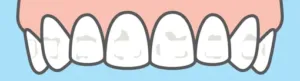 /img/26103-teeth-whitening-products.webp