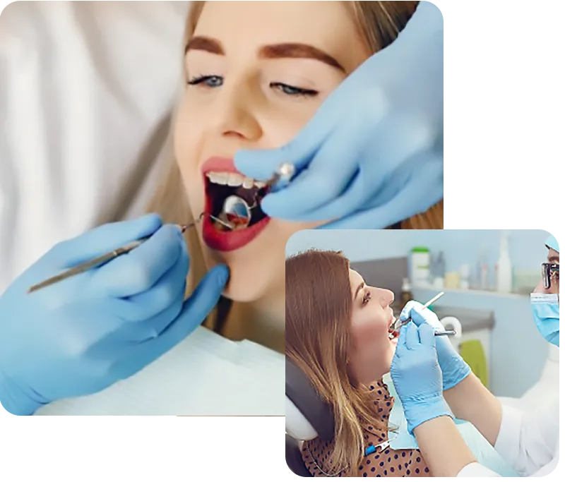 26104 in office teeth whitening