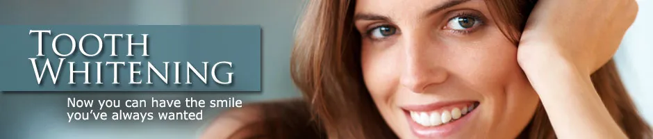 26106 coral gables teeth whitening before after