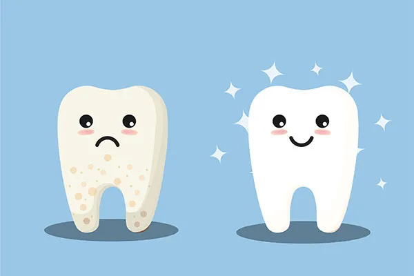 /img/26106-smiling-woman-white-teeth.webp