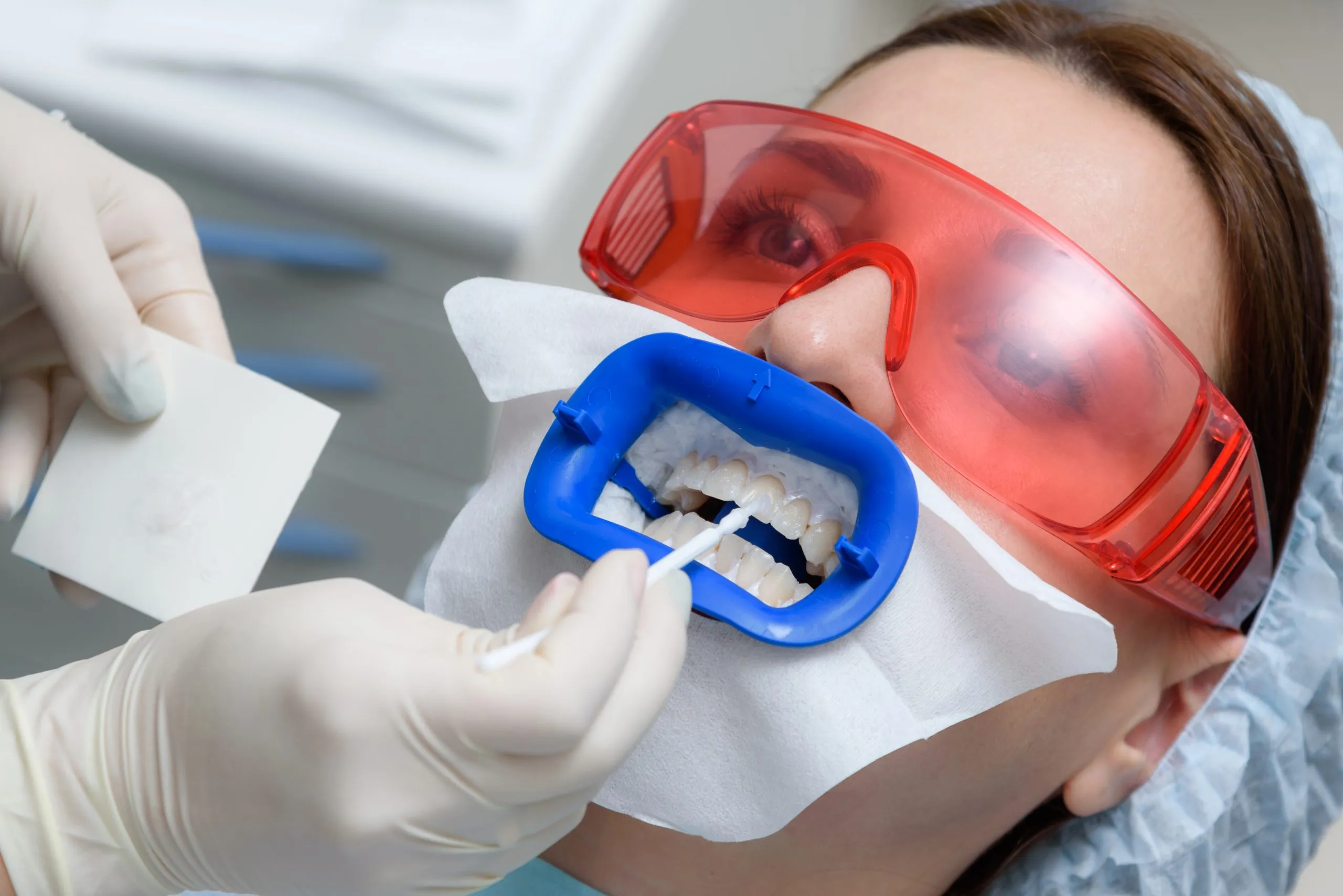 26108 tooth whitening utah 4
