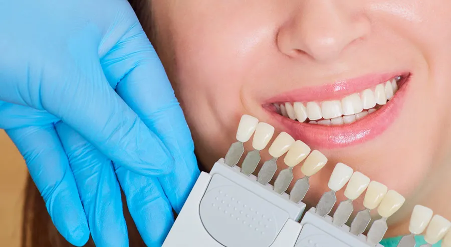 26110 acv teeth whitening before after 4