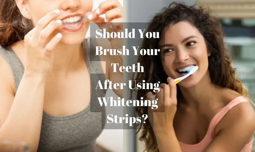 26112 at home whitening maintenance
