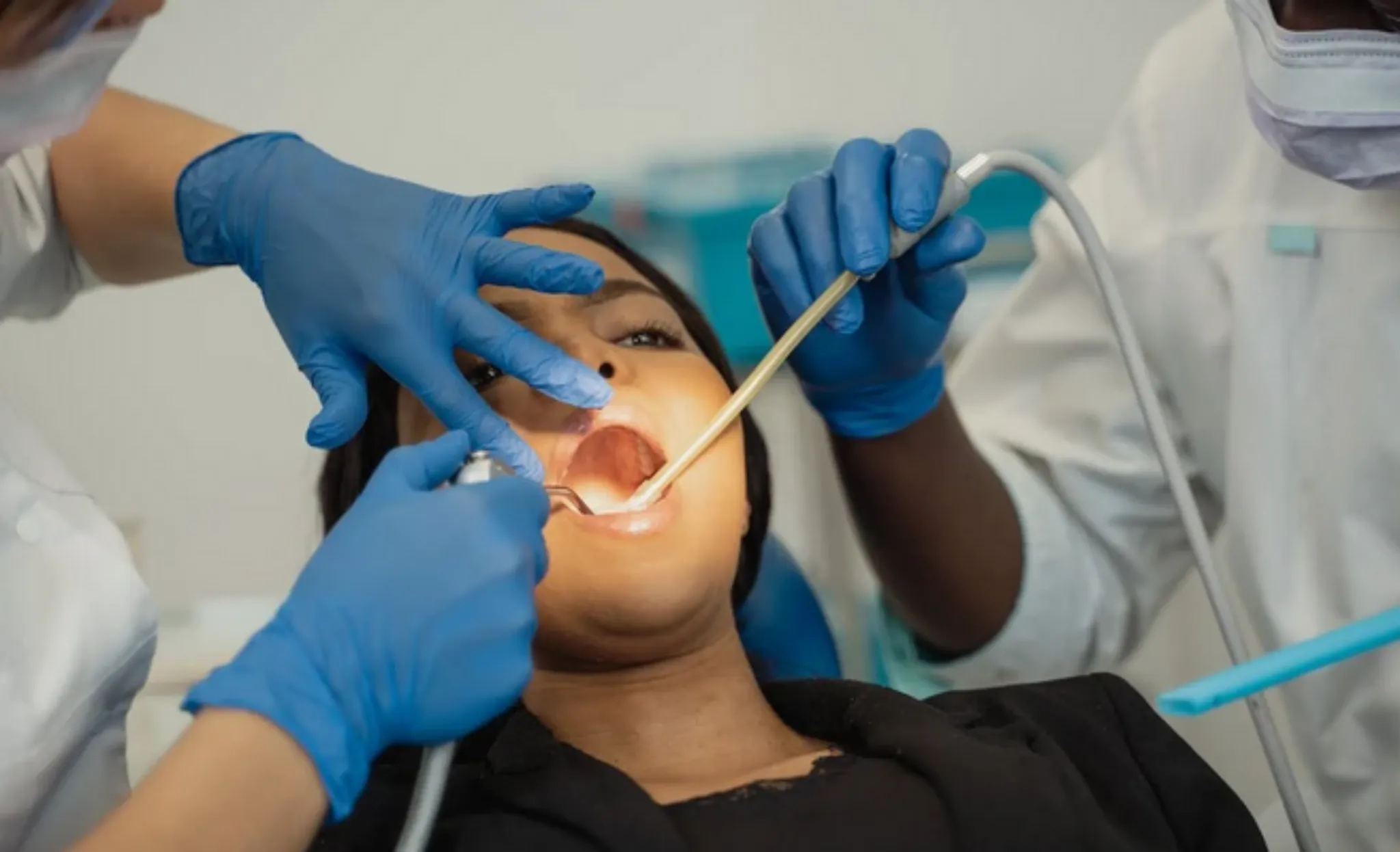 26113 teeth whitening take home kit