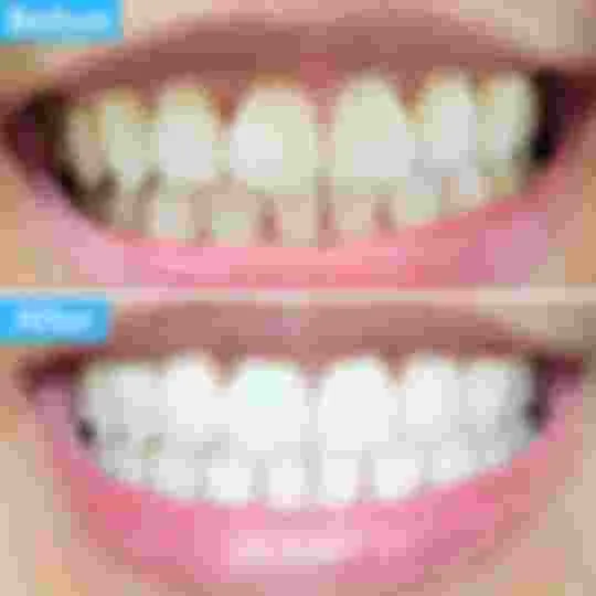 26122 polar night whitening image3