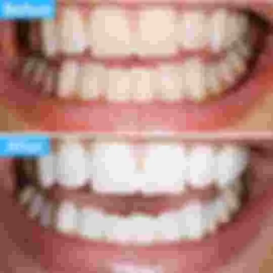 26122 polar night whitening image4