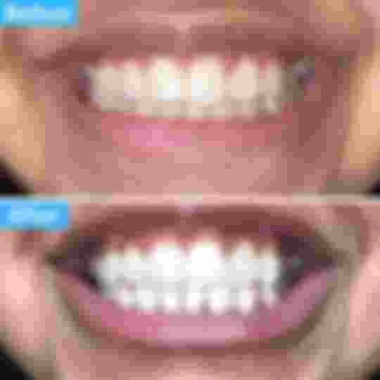 26122 polar night whitening image5