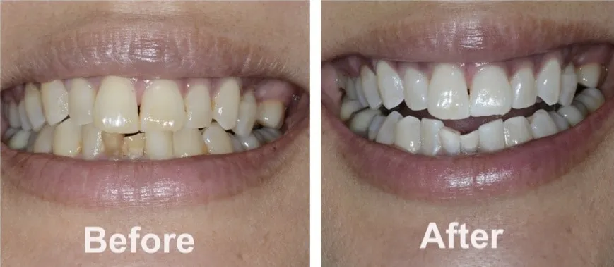 /img/26125-regular-dental-checkups.webp