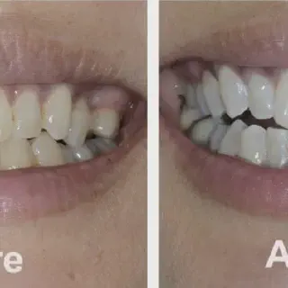 /img/26125-regular-dental-checkups.webp
