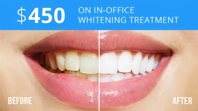 26126 at home teeth whitening