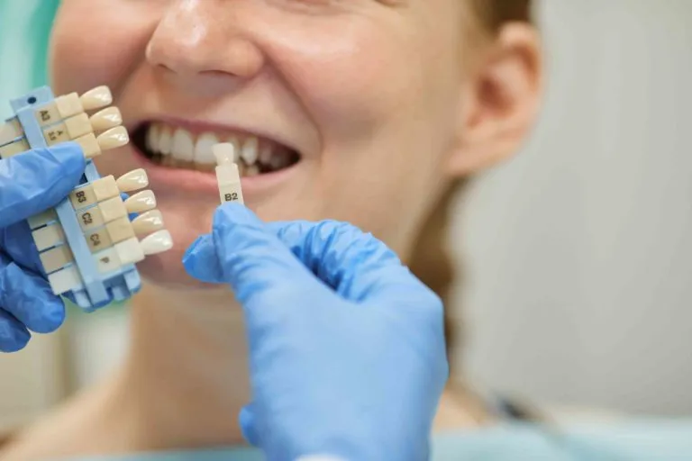26126 teeth whitening results