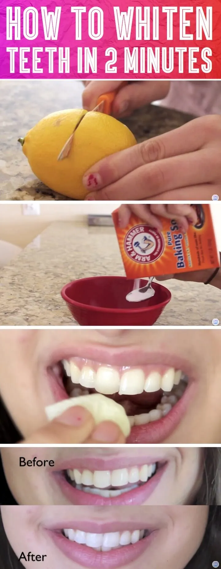 26127 activated charcoal teeth